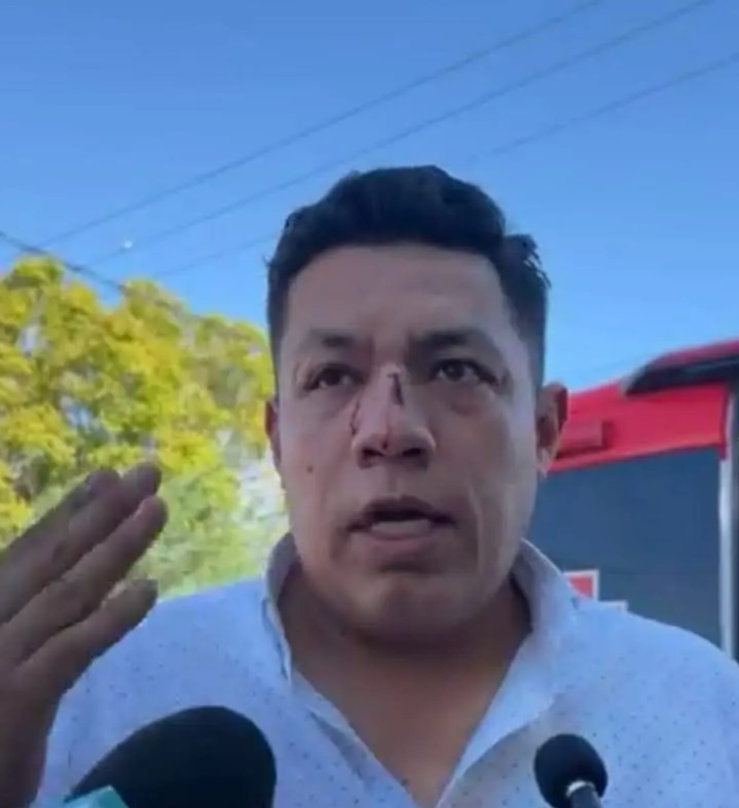 EL PERIODISTA JORGE HERAS FUE AGREDIDO EN MEXICALI DONDE RESIDE, POR HACER SU TRABAJO, LA CONDENA ES GENERALIZADA