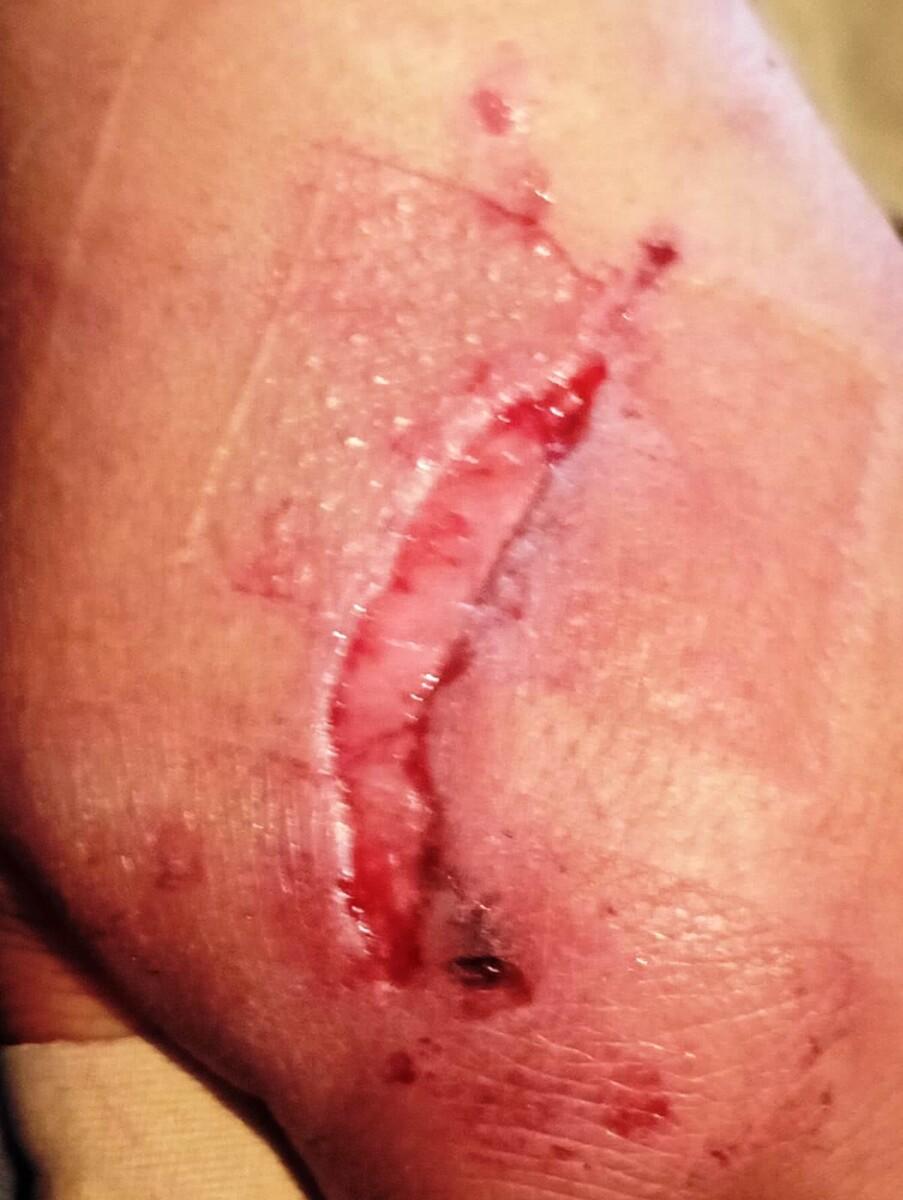 Un perro raza pitbull agresivo ataca a niños y adultos en fraccionamiento Arboledas de la colonia Natura